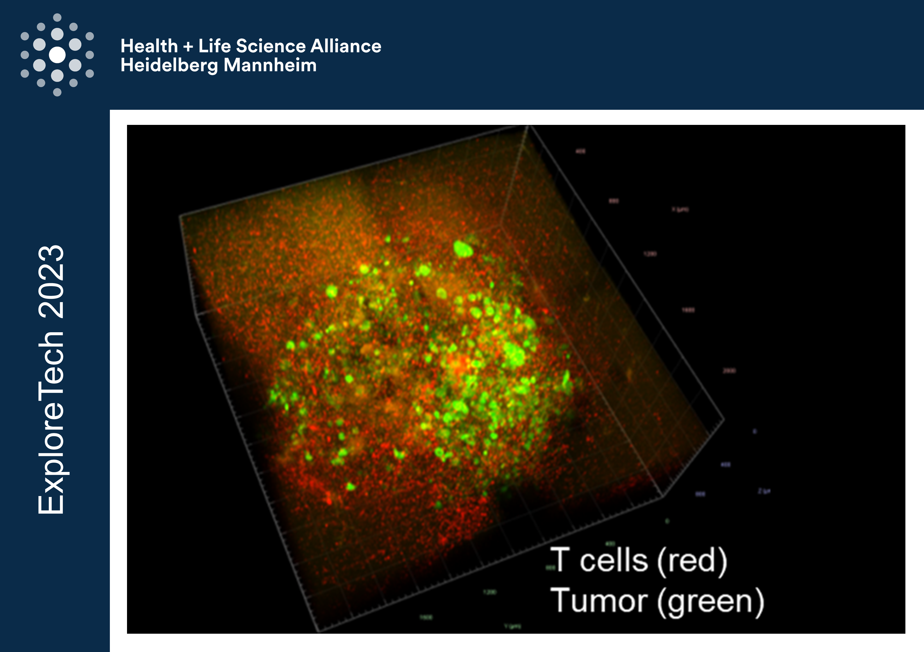 10 brain tumor immune interactions TEASER