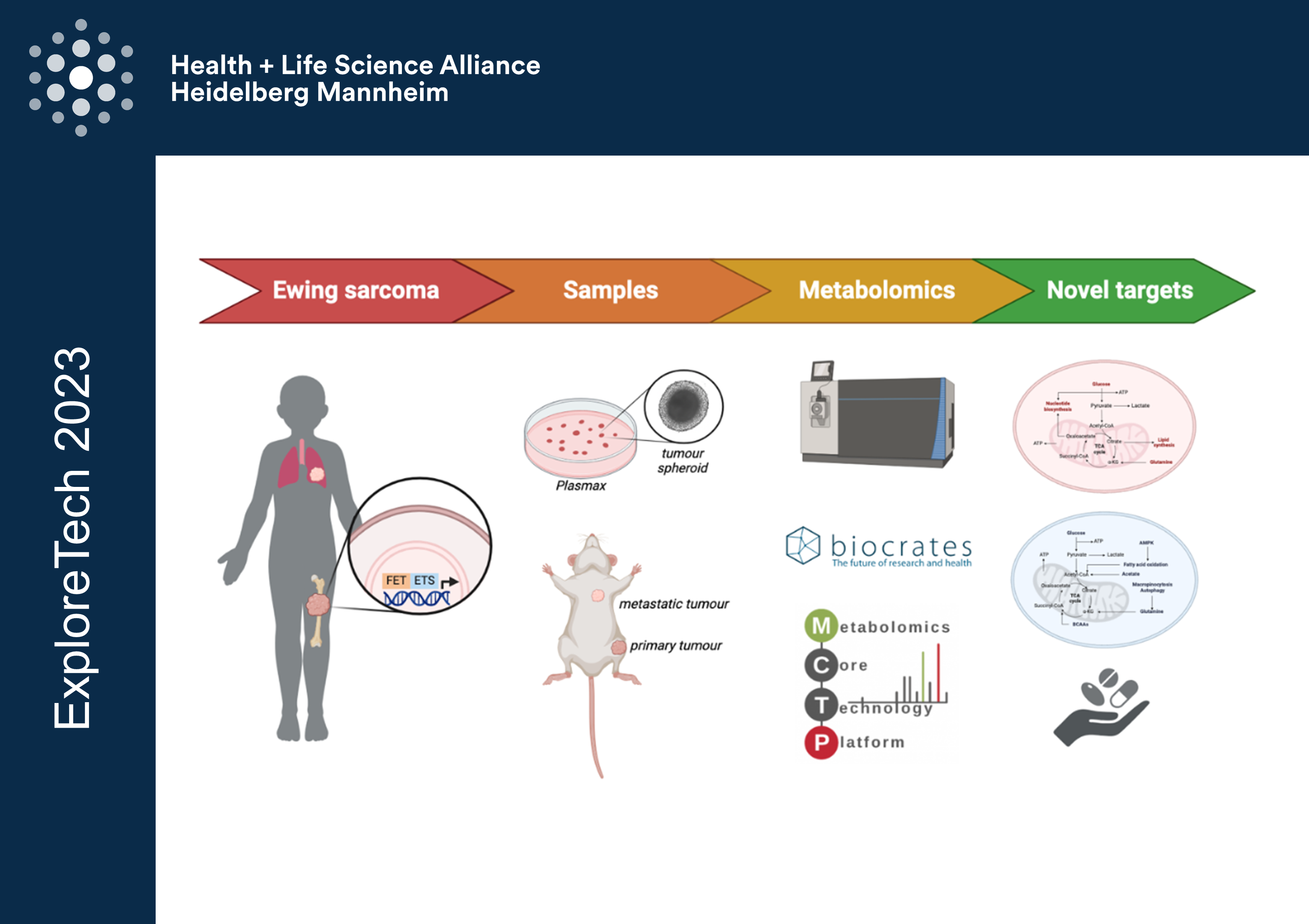 Uncovering metabolic vulnerabilities in pimary and metastatic Ewing sarcoma